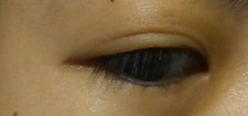 絆創膏/その他を使ったクチコミ（3枚目）