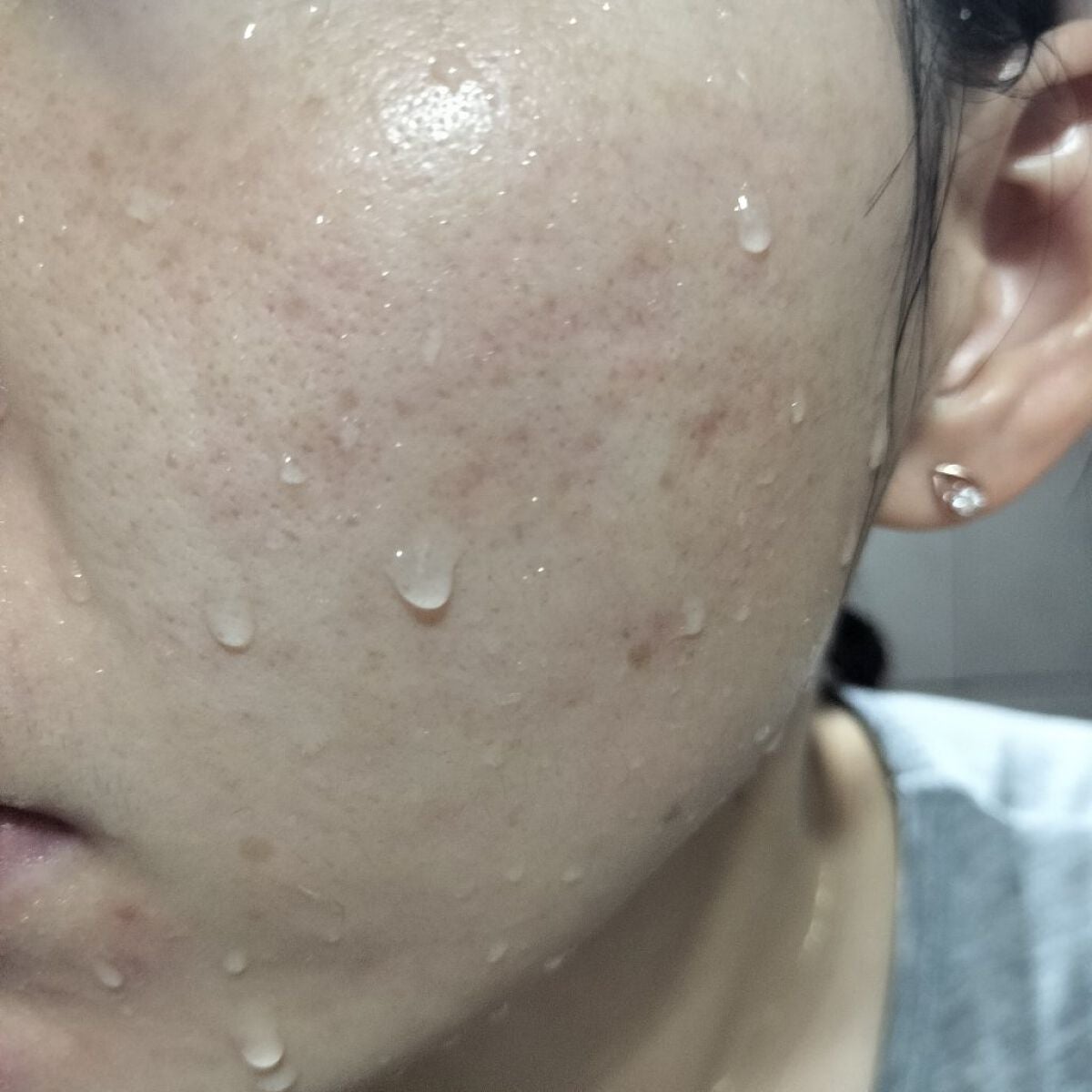 miina@汚肌工事録⚠️ on LIPS 「✍11/9の#汚肌工事録いいね❤ありがとう。うれしみです☺️/..」(2枚目)