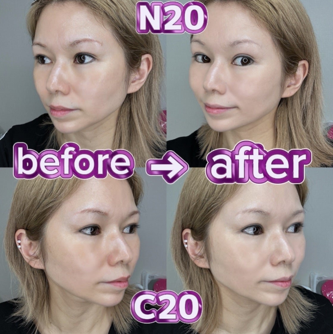 SPステイ ルミマット リキッド ファンデーション/MAYBELLINE NEW YORK/リキッドファンデーションを使ったクチコミ(4枚目)