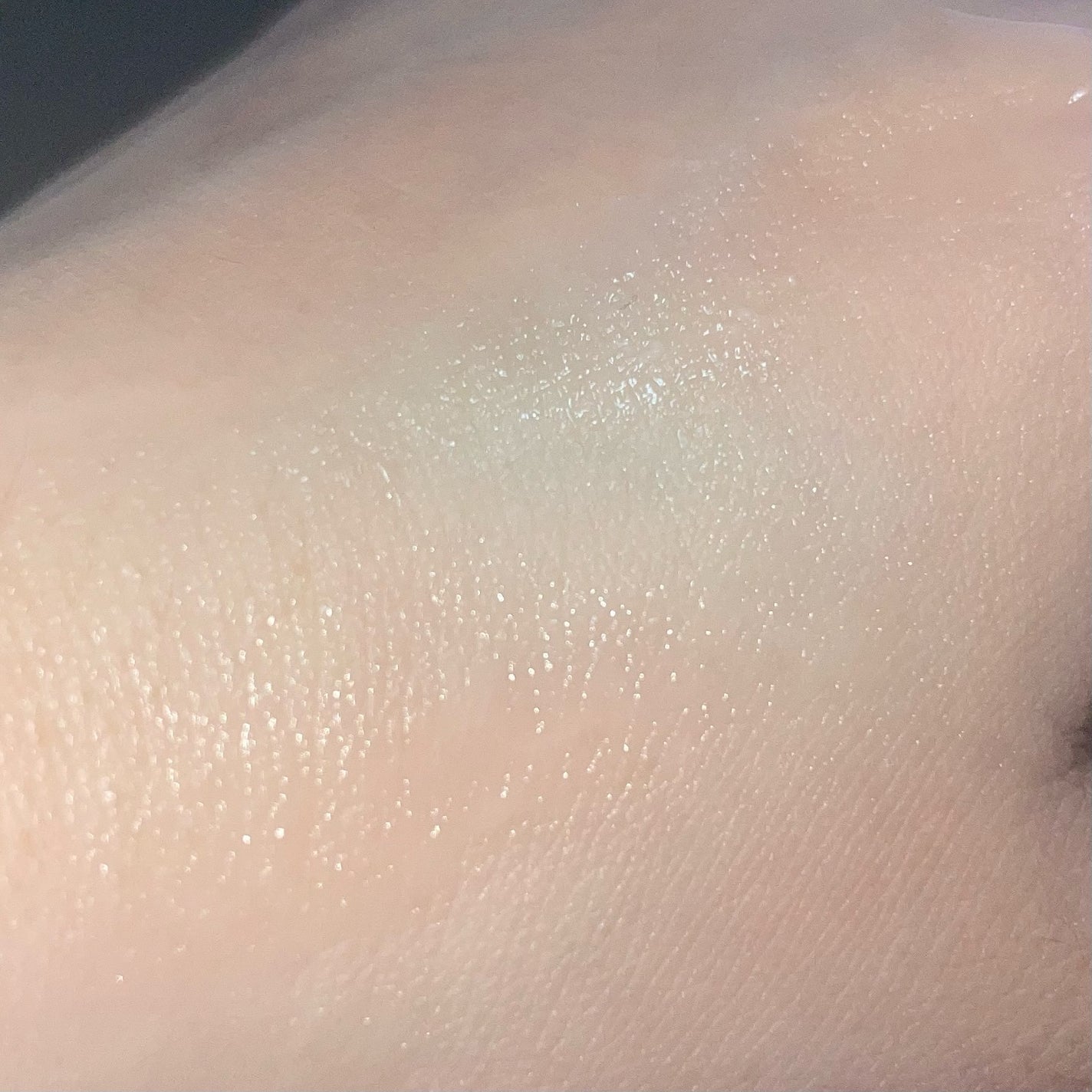 アゼペア 美容液/ネイチャーリパブリック/美容液を使ったクチコミ(3枚目)