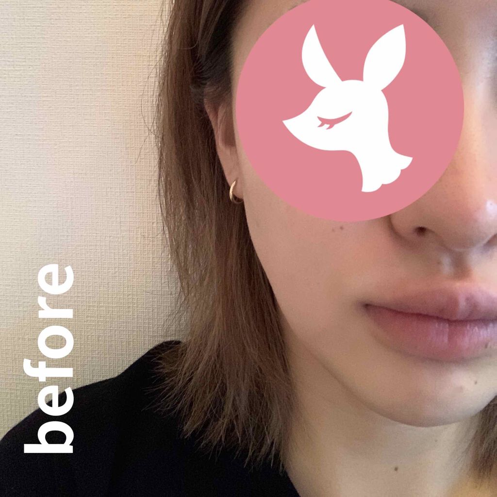 ハリフト ローラー/ハリフト/その他スキンケアグッズを使ったクチコミ（2枚目）