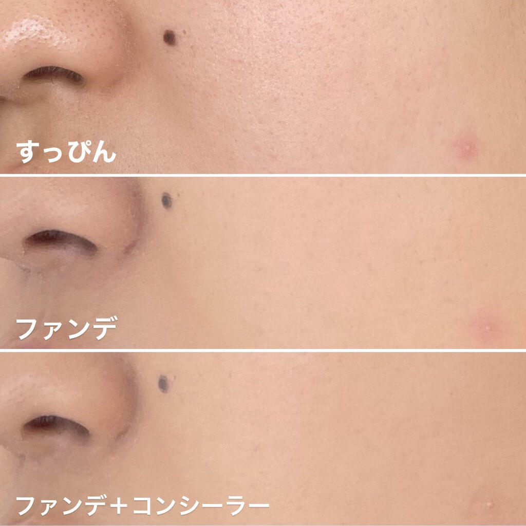 フィットミー コンシーラー/MAYBELLINE NEW YORK/リキッドコンシーラーを使ったクチコミ（2枚目）