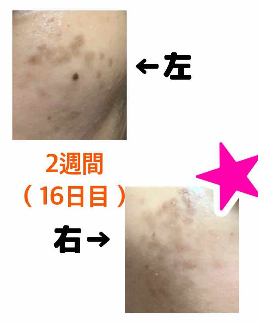 ハトムギ保湿ジェル(ナチュリエ スキンコンディショニングジェル)/ナチュリエ/美容液を使ったクチコミ(2枚目)