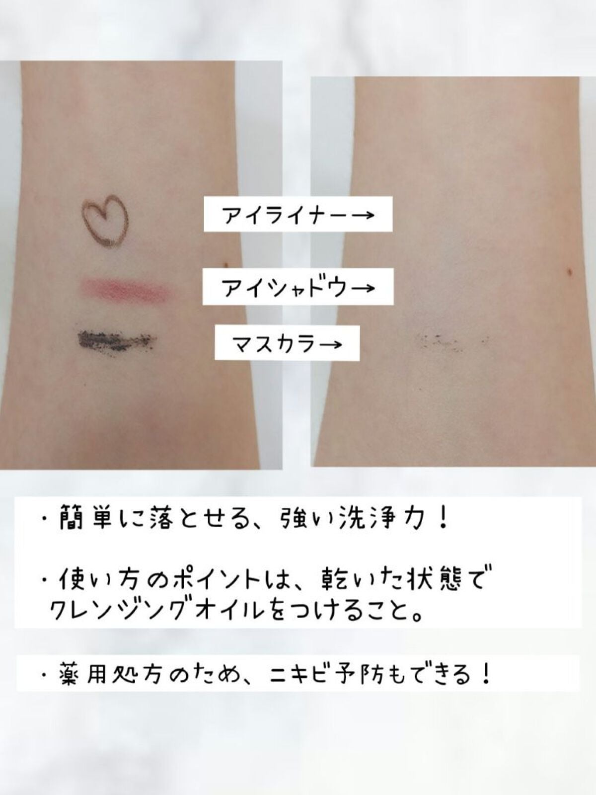 CHOIクレンジングオイル 薬用ニキビケア/肌美精/オイルクレンジングを使ったクチコミ(2枚目)