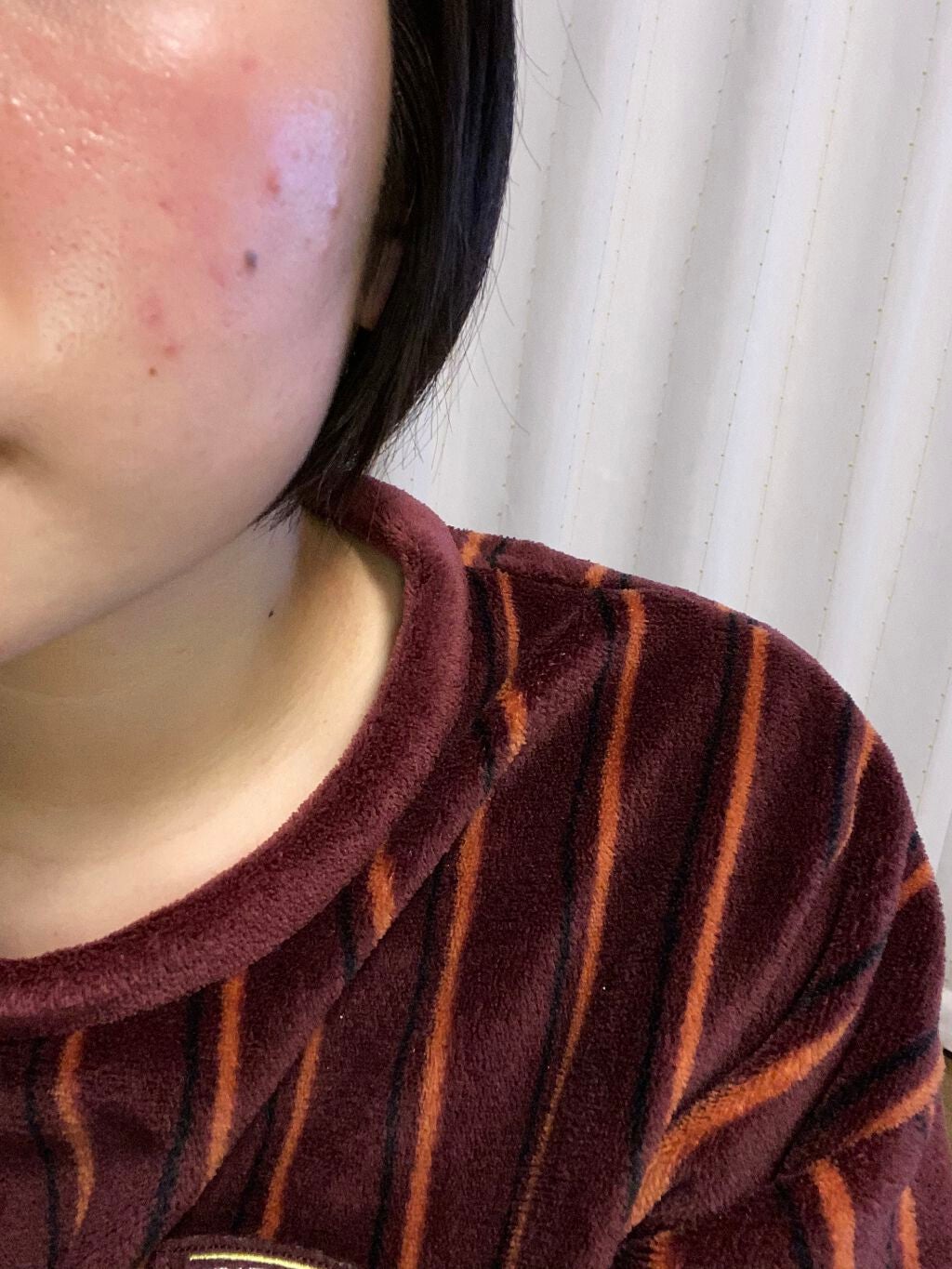 明色美顔水 薬用化粧水/美顔/化粧水を使ったクチコミ(2枚目)