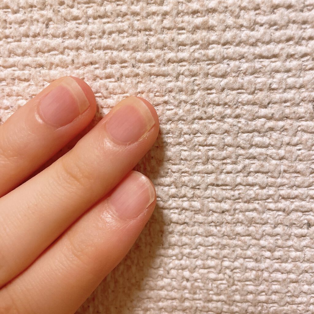 ネイルケアオイル/無印良品/ネイルオイル・トリートメントを使ったクチコミ（2枚目）