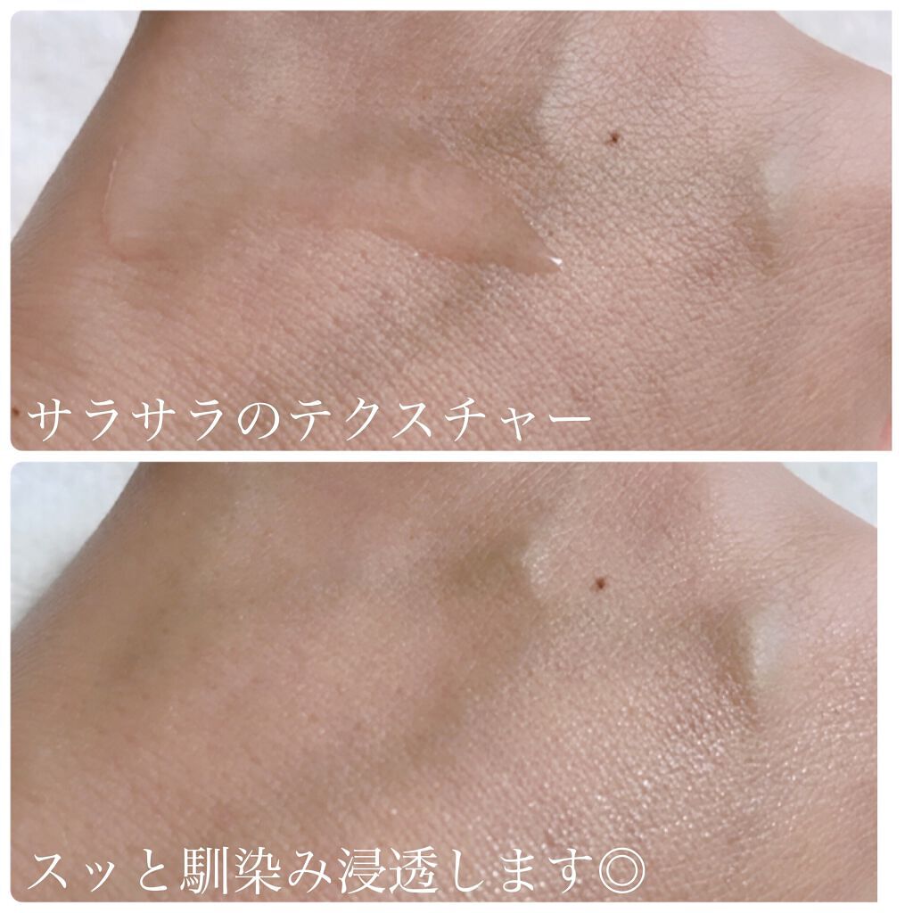 モイスチャーローション/shimaboshi/化粧水を使ったクチコミ(4枚目)