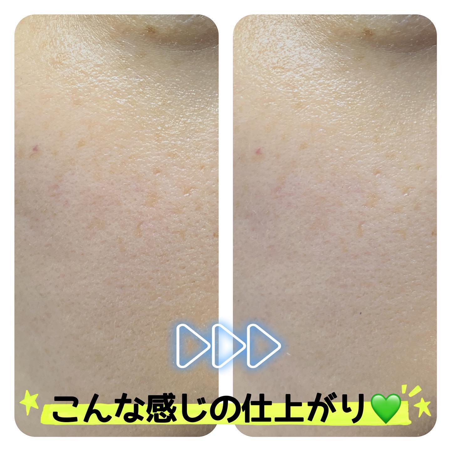 ベース クリアUVプロテクター/Ｎ organic/日焼け止めクリームを使ったクチコミ（3枚目）