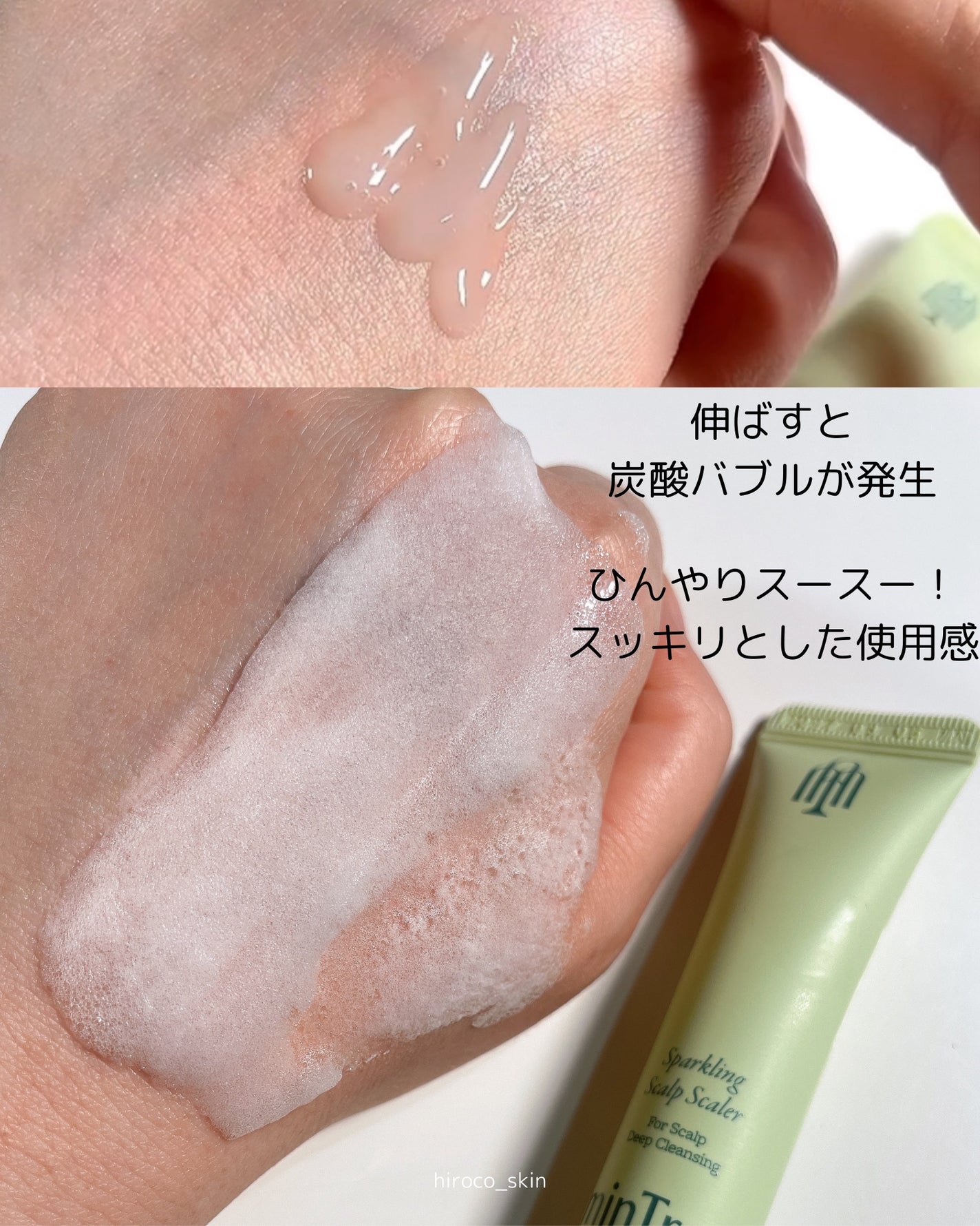 スパークリングスカルプスケーラー/ミンツリー/頭皮ケアを使ったクチコミ(4枚目)