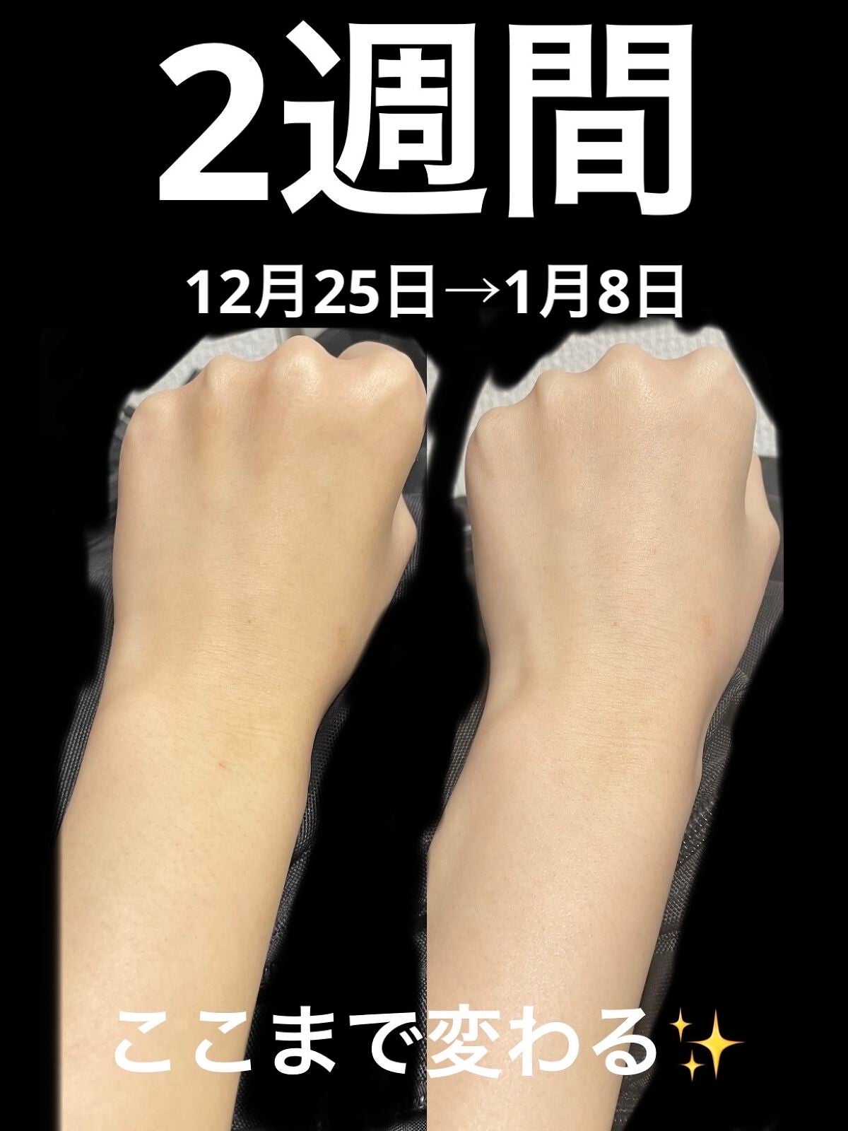 スキンアクア トーンアップUVエッセンス/スキンアクア/日焼け止めクリームを使ったクチコミ(1枚目)