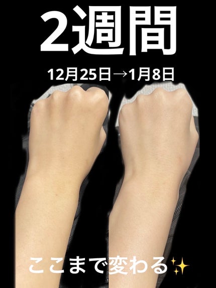 スキンアクア トーンアップUVエッセンス/スキンアクア/日焼け止めクリームを使ったクチコミ(1枚目)