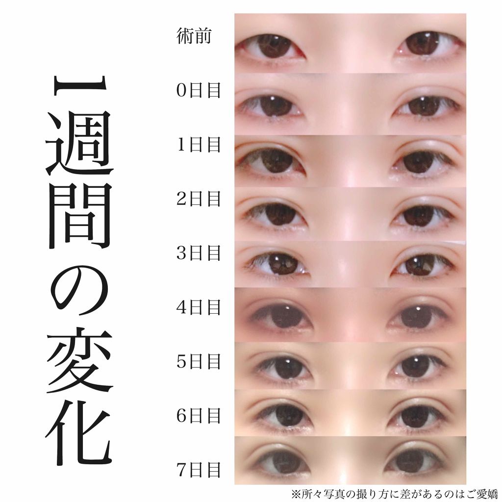 あたる on LIPS 「✼••┈┈┈┈┈┈┈┈┈┈┈┈┈┈┈┈••✼まいど!あたるです..」(1枚目)