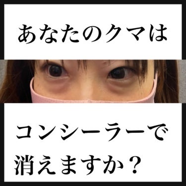 ディエム クルール カラーブレンドパウダーコンシーラーのクチコミ「⭐️クマで悩んでる方みてください！！⭐️

あなたのクマはコンシーラーで消えますか？
電車の窓.....」（1枚目）