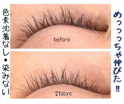 Lie~eyelash serum~/株式会社K&S/まつげ美容液を使ったクチコミ(1枚目)