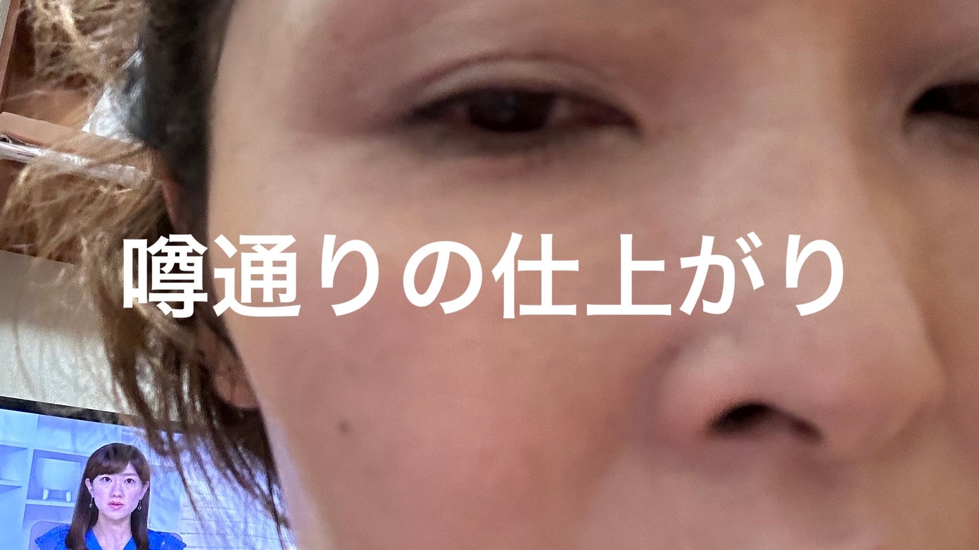 リシェ レッドトリック アイコンシーラー/Visée/パレットコンシーラーを使ったクチコミ(6枚目)