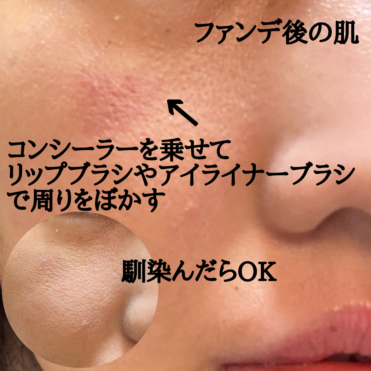 ディオールスキン フォーエヴァー スキン コレクト コンシーラー/Dior/リキッドコンシーラーを使ったクチコミ（3枚目）