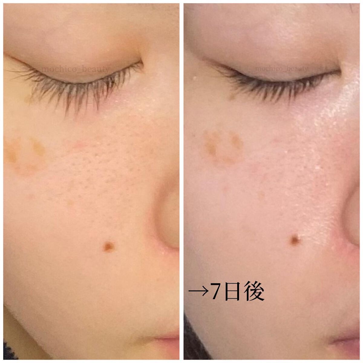 ナチュラルグロウエッセンス/inersential/美容液を使ったクチコミ(5枚目)