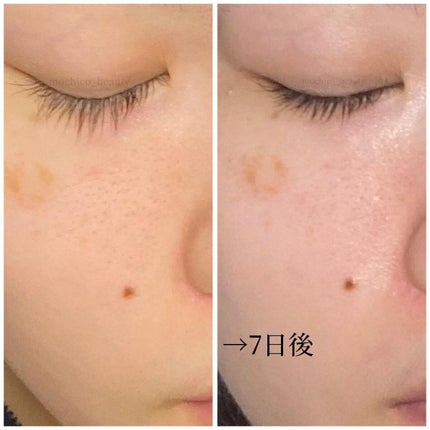 ナチュラルグロウエッセンス/inersential/美容液を使ったクチコミ(5枚目)