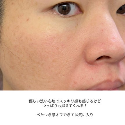 ユアンソープ 清玉/ユアンソープ/ボディ石鹸を使ったクチコミ(6枚目)