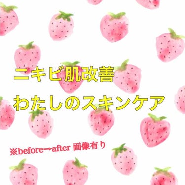 はじめまして！LIPSでは初めての投稿となります。
うさ田です🐰

社会人になってから約3年間悩まされてきた大人ニキビ。
いろんな商品を試してやっとたどり着いた、
おすすめのスキンケアをご紹介したいと思