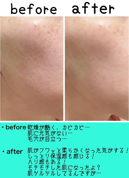 ハニーマスク/I'm from/洗い流すパック・マスクを使ったクチコミ(10枚目)