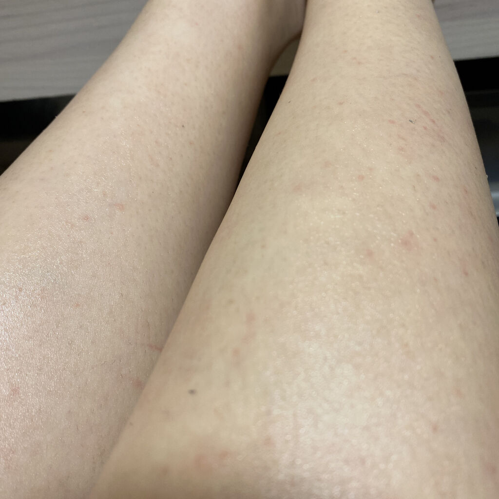 除毛クリームキット敏感肌用/エピラット/除毛クリームを使ったクチコミ（1枚目）