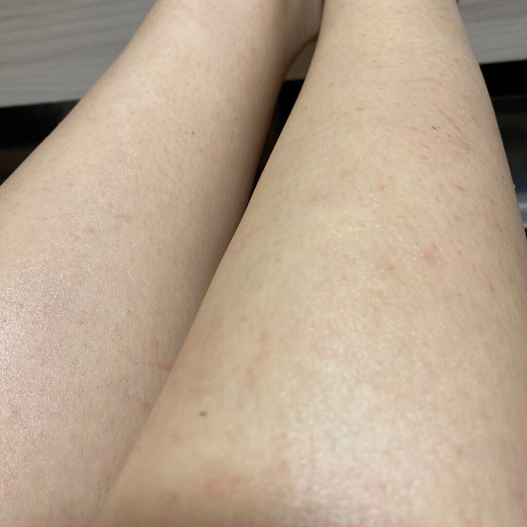 除毛クリームキット敏感肌用/エピラット/除毛クリームを使ったクチコミ(1枚目)