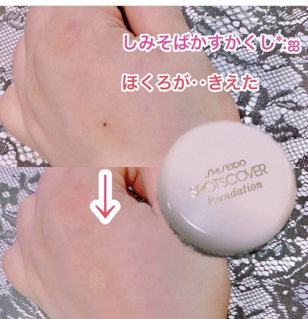 スポッツカバー ファウンデイション/SHISEIDO/クリームコンシーラーを使ったクチコミ（1枚目）