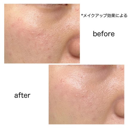 ディオールスキン フォーエヴァー フルイド グロウ/Dior/リキッドファンデーションを使ったクチコミ(6枚目)