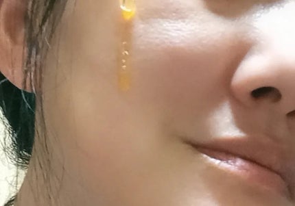 ミシャ ビタシープラス 美容液【日本処方】/MISSHA/美容液を使ったクチコミ(3枚目)