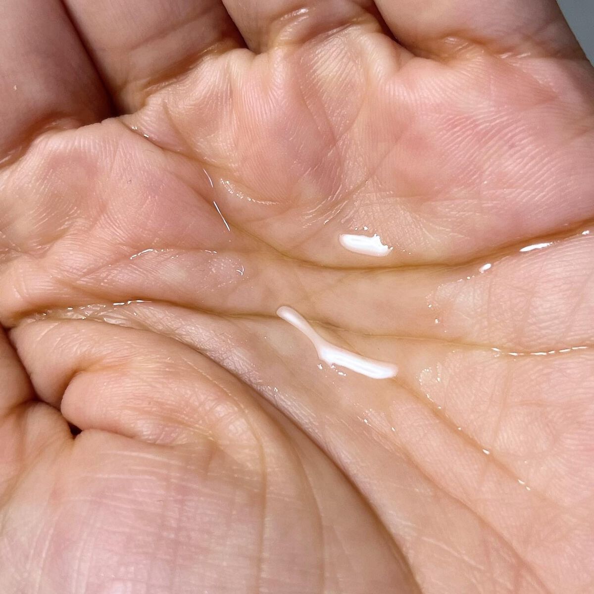 薬用シミレイサー美容液/シミレイサー/美容液を使ったクチコミ（3枚目）