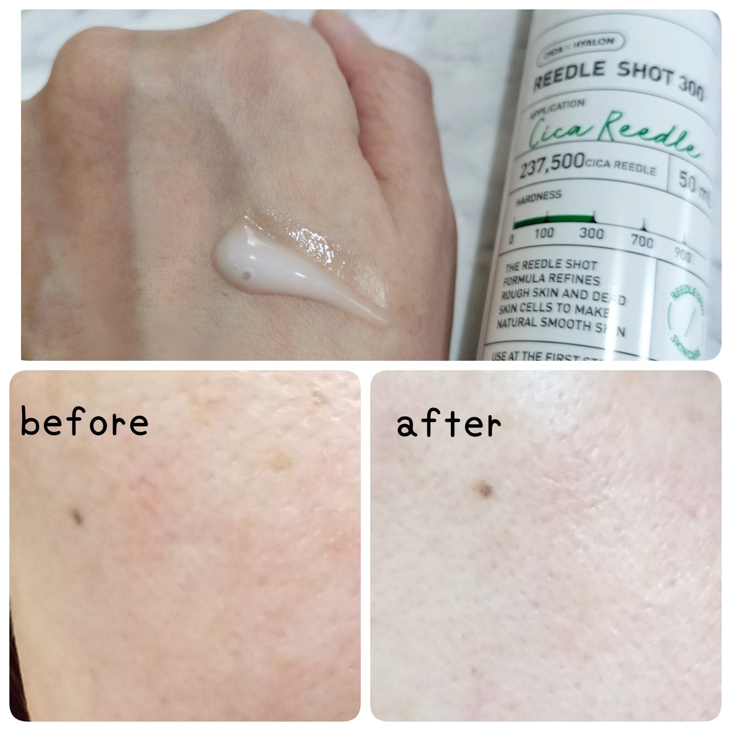 リードルショット300/VT/美容液を使ったクチコミ(2枚目)