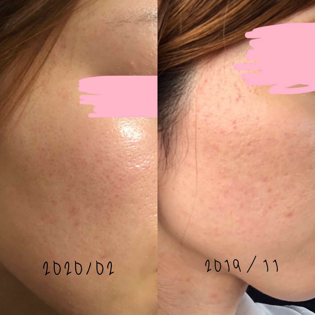 フェイシャル クレンジング オイル/Aesop/オイルクレンジングを使ったクチコミ（3枚目）