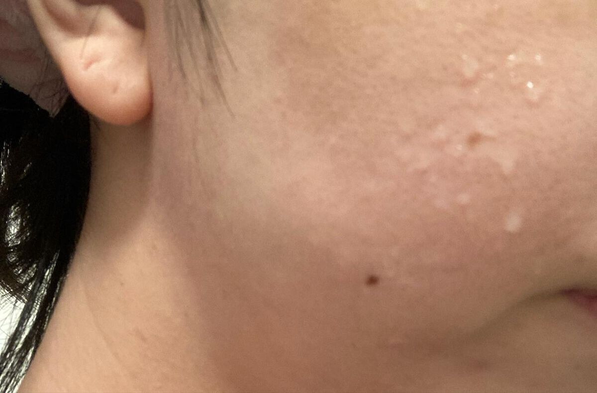 エマルジョンリムーバー　300ml/200ml/水橋保寿堂製薬/その他洗顔料を使ったクチコミ（2枚目）