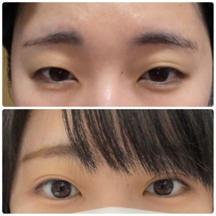 アルビオン パウダレスト/ALBION/パウダーファンデーションを使ったクチコミ(2枚目)