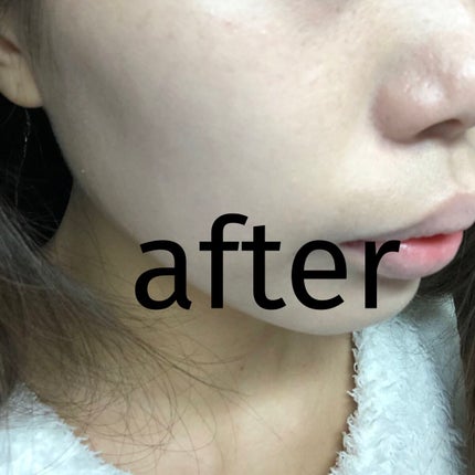 ゼン ウェア フルイド/DECORTÉ/リキッドファンデーションを使ったクチコミ(3枚目)