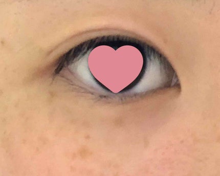 アイビューティー フィクサー WP/アストレア ヴィルゴ/二重まぶた用アイテムを使ったクチコミ(1枚目)