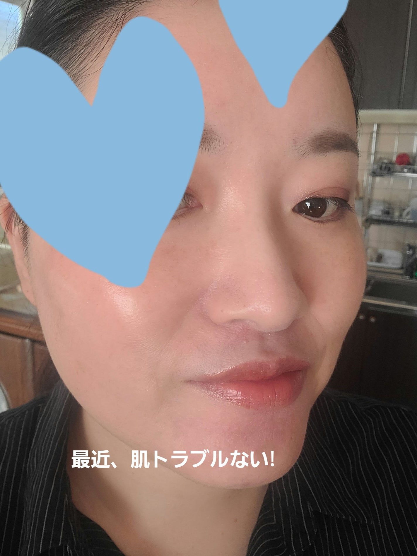 モンダミン プレミアムケア センシティブ/モンダミン/マウスウォッシュ・スプレーを使ったクチコミ(4枚目)