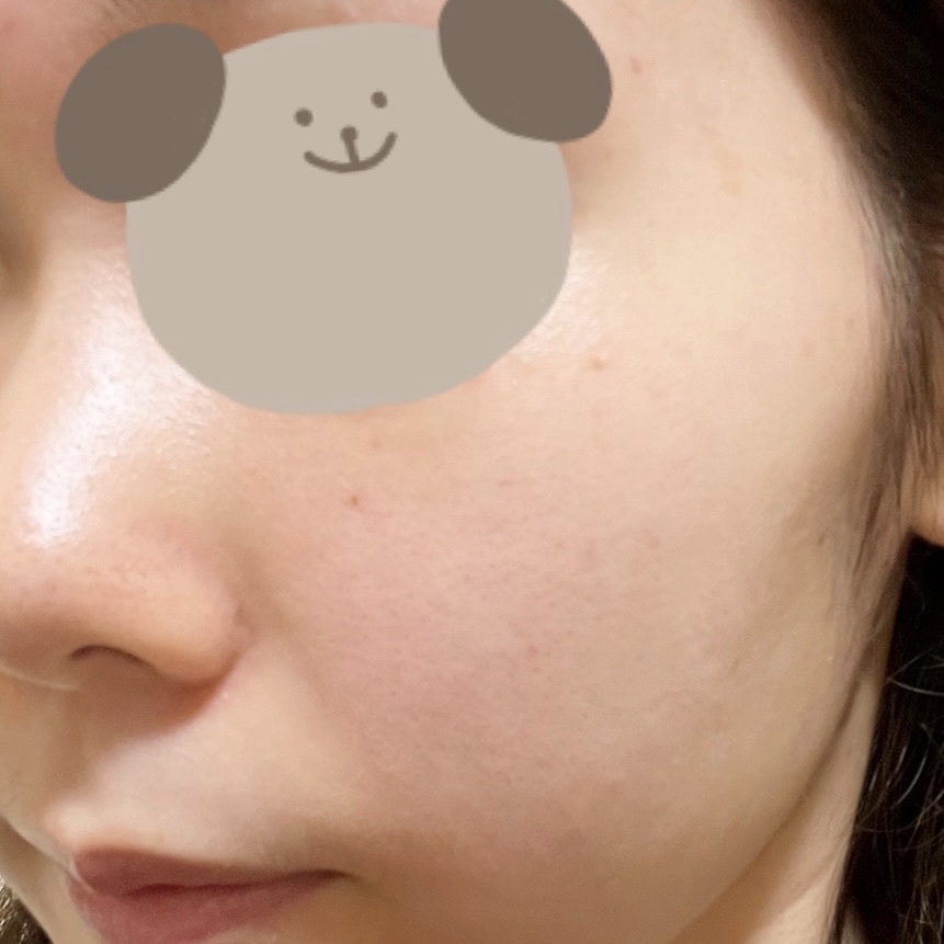 オードムーゲ 薬用ローション（ふきとり化粧水）/オードムーゲ/拭き取り化粧水を使ったクチコミ（3枚目）