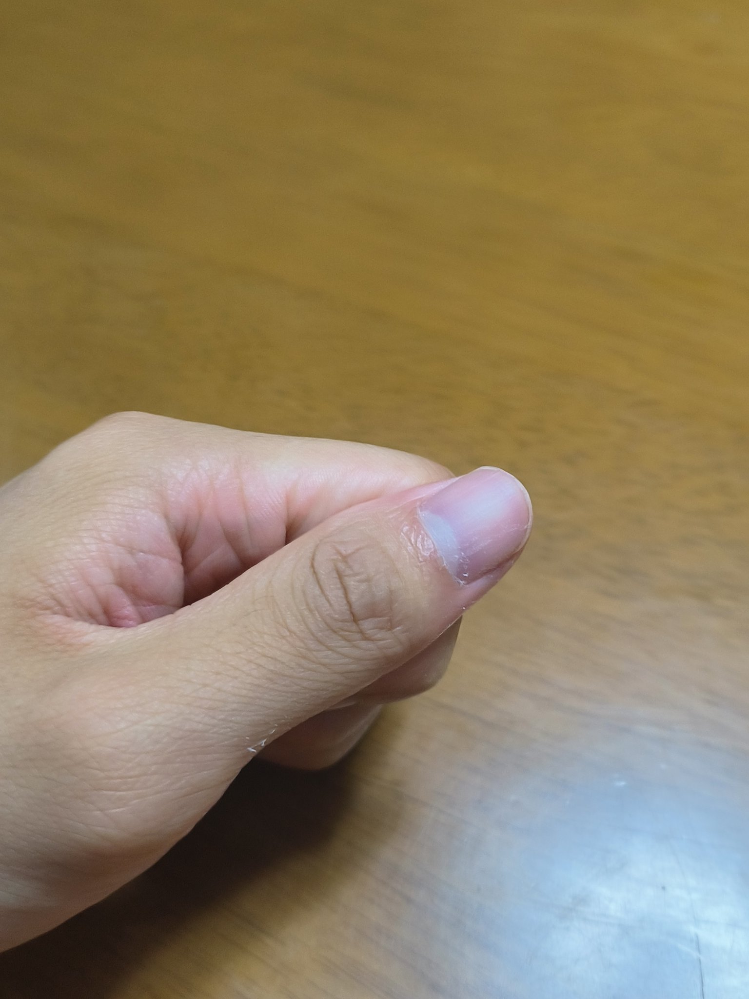 Mimits クイックエナメルリムーバー　BNR-01/ビー・エヌ/除光液を使ったクチコミ（3枚目）