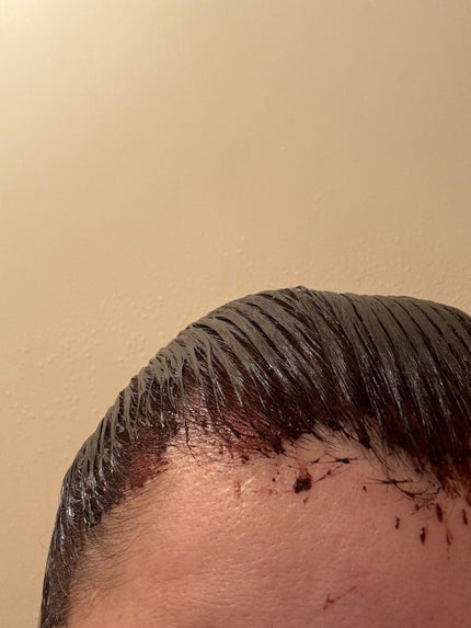 グロスカラートリートメント /マリンボーテ/洗い流すヘアトリートメントを使ったクチコミ(7枚目)