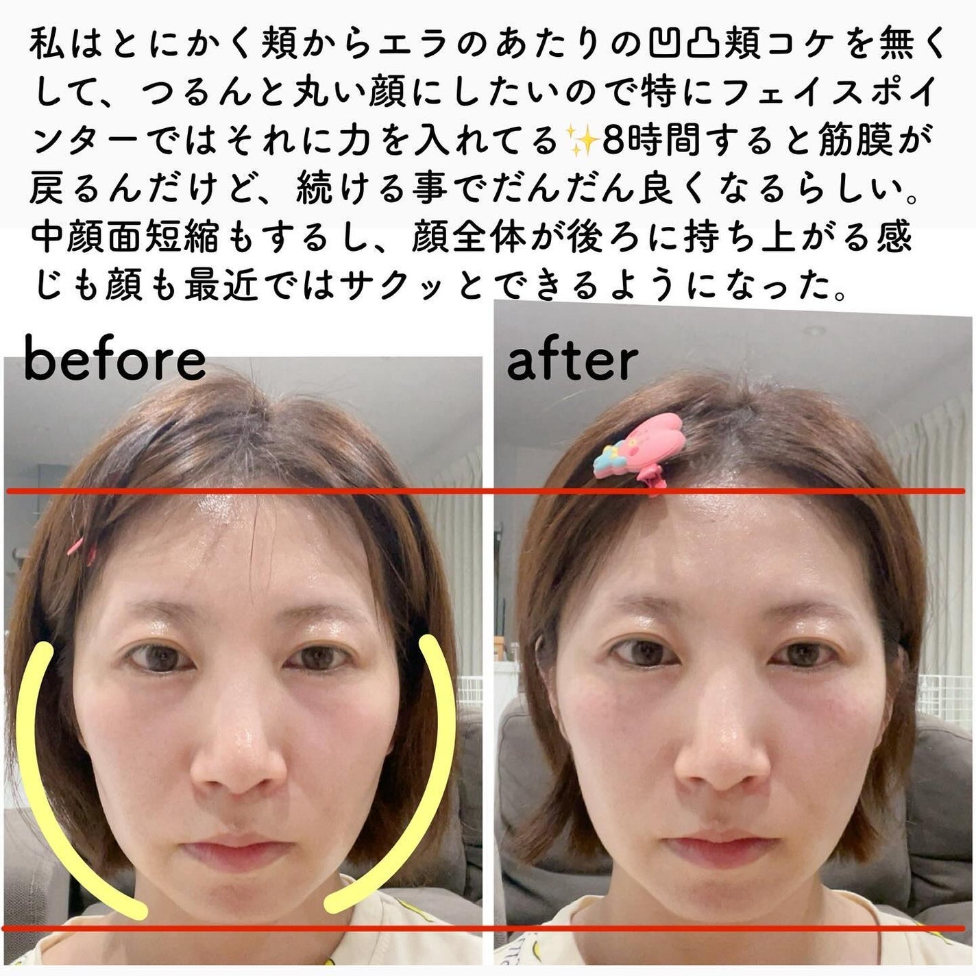 試してみた】AGE-R ウルトラチューン40.68 MEDICUBEのリアルな 試してみた】AGE-R ウルトラチューン40.68 MEDICUBEのリアルな