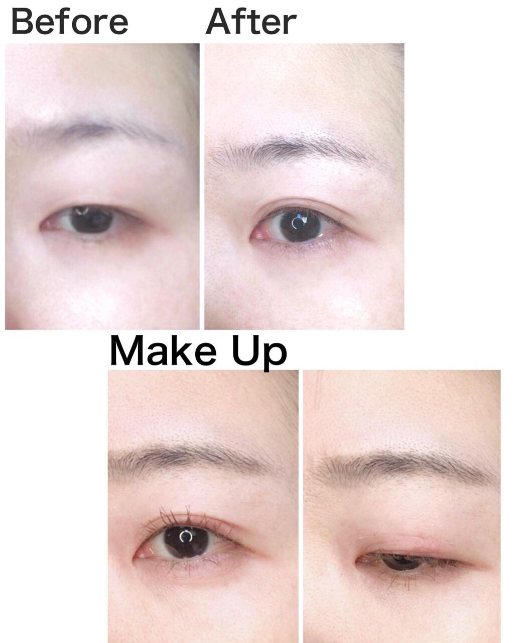 メザイク クリップ カッター ファイバー専用カッター/メザイク/二重まぶた用アイテムを使ったクチコミ(10枚目)