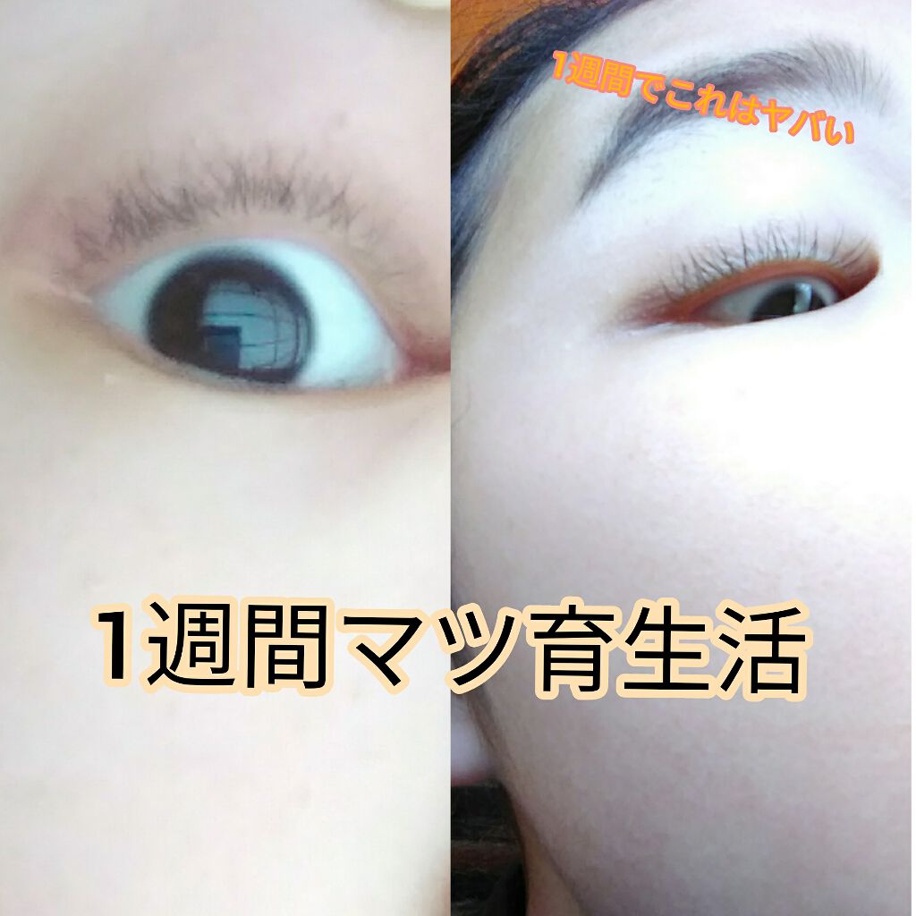 ローヤルゼリー配合 栄養ローション/DAISO/美容液を使ったクチコミ(1枚目)