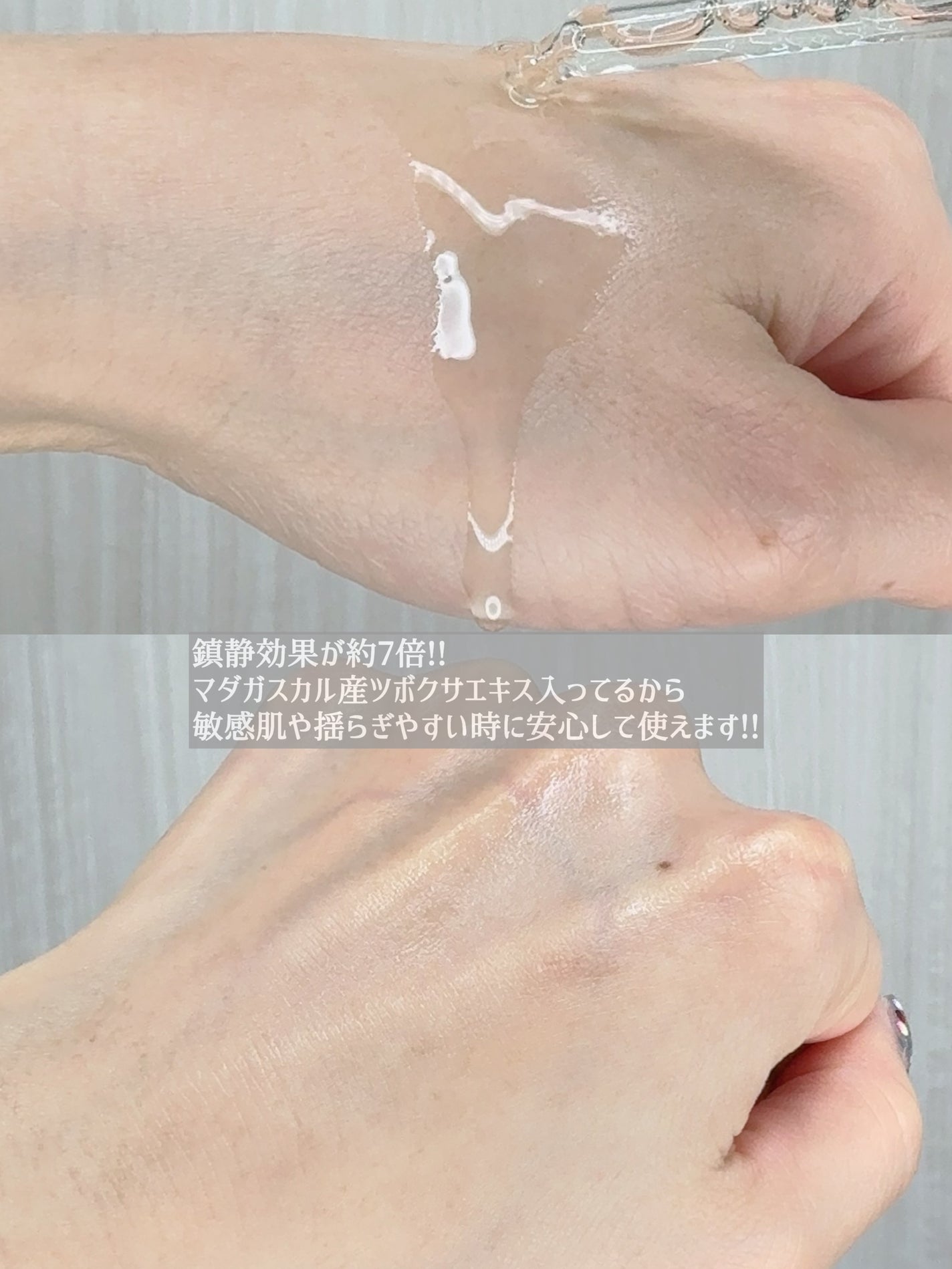 センテラ アンプル/SKIN1004/美容液を使ったクチコミ(4枚目)