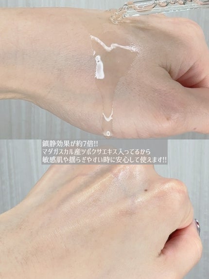 センテラ アンプル/SKIN1004/美容液を使ったクチコミ(4枚目)