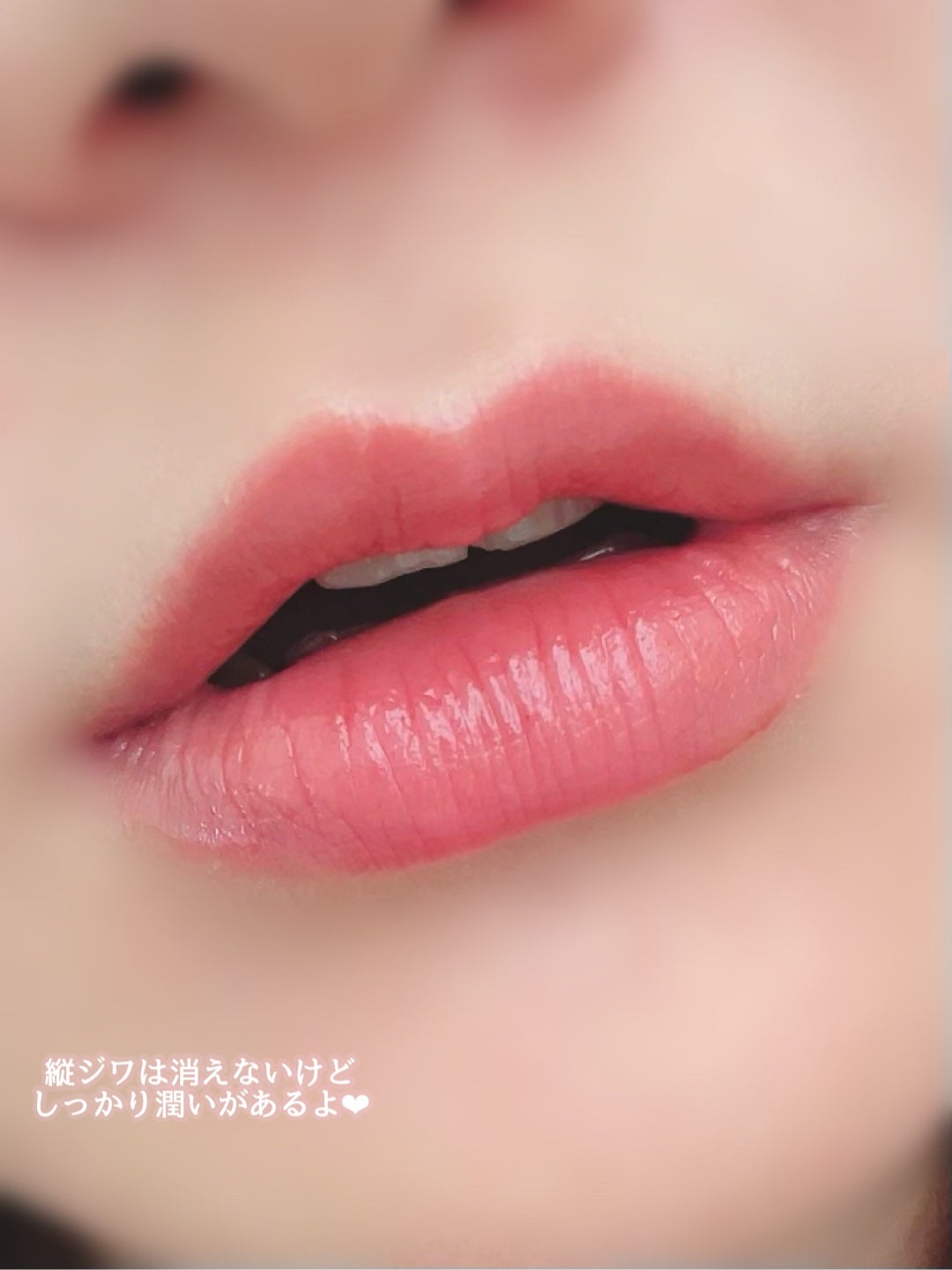 ごんす@YouTube始めました on LIPS 「《デイジーク赤ちゃん唇になるリップ❤︎》可愛くて買ってみたデイ..」(4枚目)