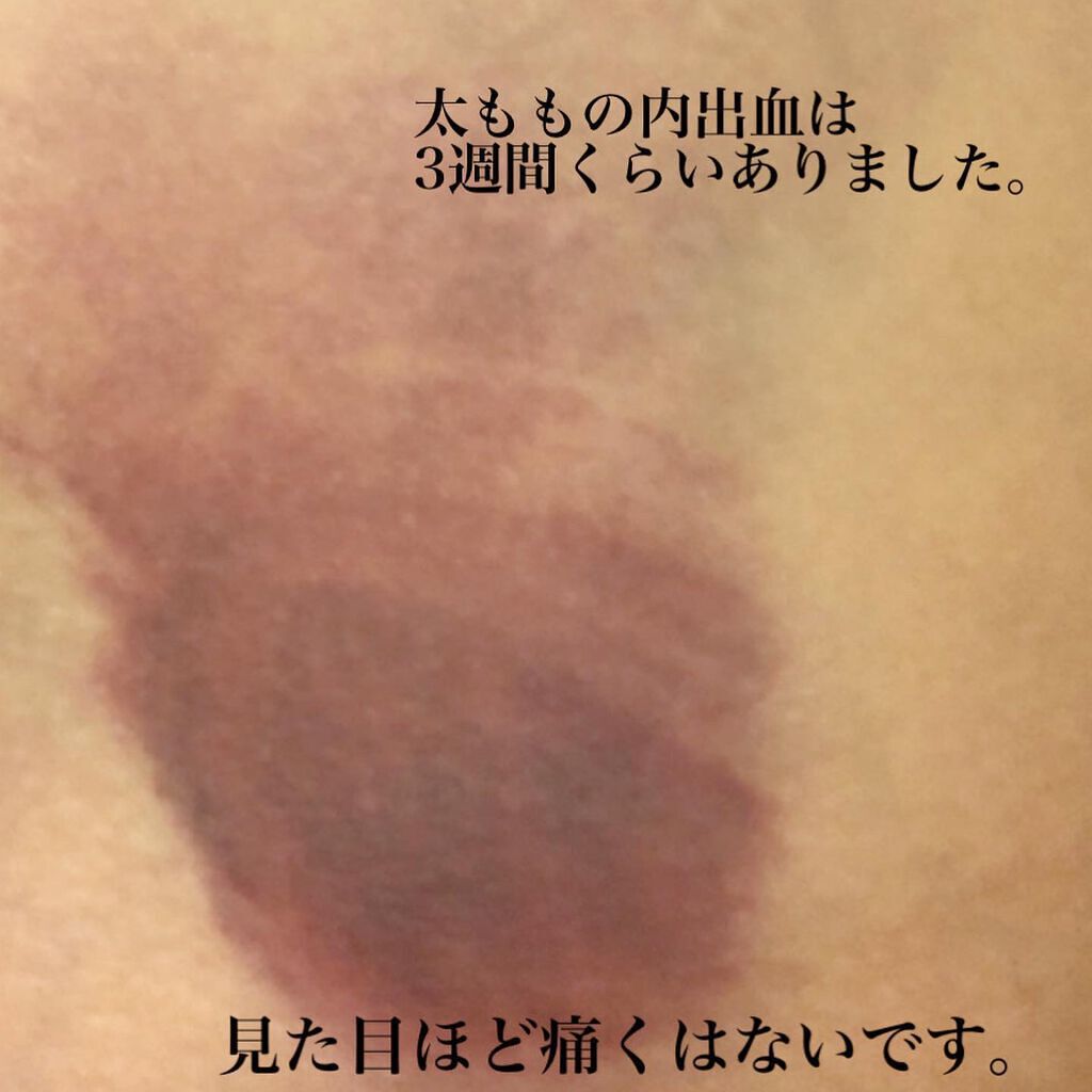 mipo1212ð€ on LIPS ãâšâšç®ã®äžã®ã¯ãåãïŒè±èïŒèèªæ³šå
¥ã¬ãâšï¿œï¿œãåŸ
ããããŸãã..ãïŒ6æç®ïŒ