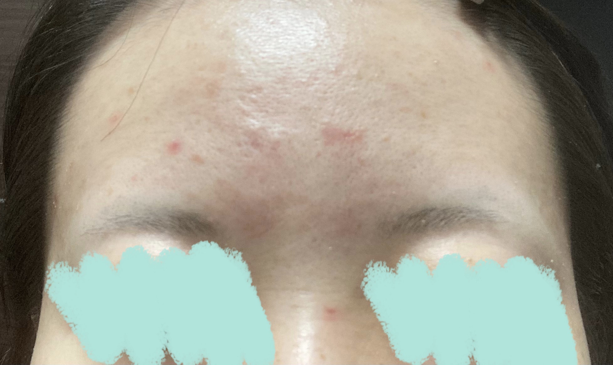 薬用ホワイトニングローションα EX/TOUT VERT/化粧水を使ったクチコミ（3枚目）