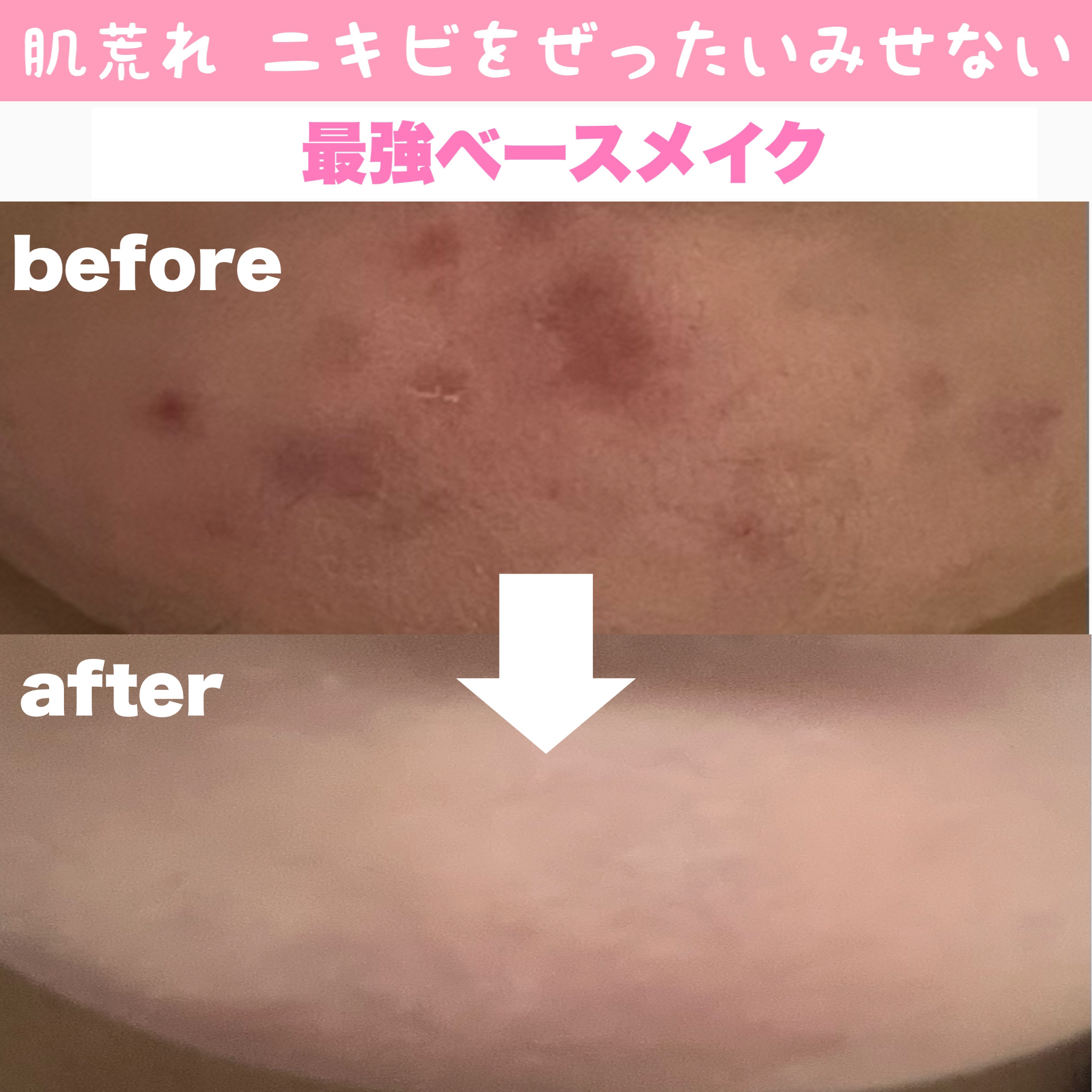 ディオールスキン フォーエヴァー スキン コレクト コンシーラー 2Wウォーム/Dior/リキッドコンシーラーを使ったクチコミ（1枚目）